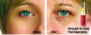 Vanquish Before & After